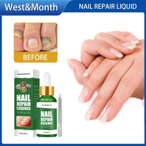 West Month Nail Repair Liquid Nail Care Treatment Nail Treatment Care Nail Treatment Repair Gel Nail Fungus Treatment Serum Nail Treatment Essence Fungal Removal Nail Fungul Paronychia Anti Infection Repair Toe Gel Tool Foot Care Essence（30ml）