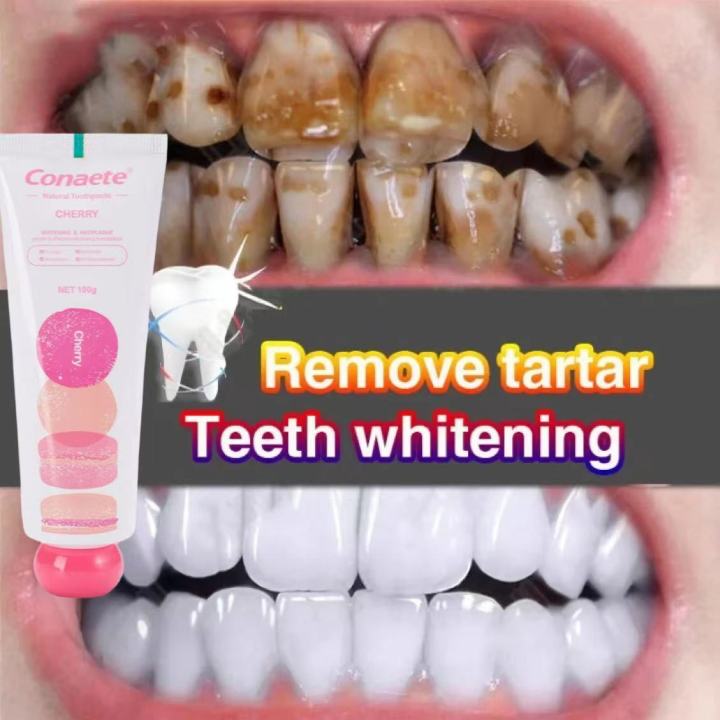 Toothpaste Pasta gigi pemutih gigi menghapuskan tartar gigi