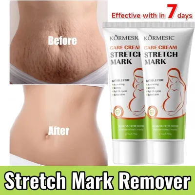 Anti Stretch Mark Cream scar cream Pregnancy Scar Removal Repair Cream Stretch Marks Anti-Wrinkle Maternity Skin Repair