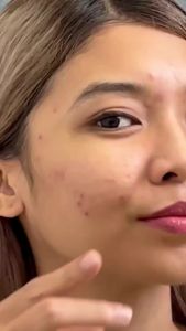 Anua Original Peach 77 Niacin Essence Toner 250ml – Brightening Hydrating & Glow Booster Toner with Niacinamide For Glass Skin