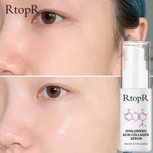 RtopR Hyaluronic Acid Collagen Face Serum Acne Treatment Anti-Wrinkle Skin Care Essence Whitening Facial Serum 20ml
