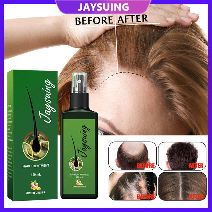 Jaysuing Hair Treatment Hair Growth Thickens And Nourishes Roots ...