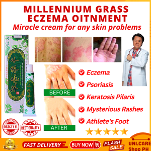 100% EFFECTIVE MIRACLE Cream Original MlLLENNlUM⭐⭐⭐ Psoriasis Eczema Rosacea Acne Keratosis Pilaris Rashes Fungal Infections Athletes Foot Ringworm Dermatitis Women Genital Itching Hemorrhoids Scabies Atoderma Cream Ointment for Itchy Skin and Allergy