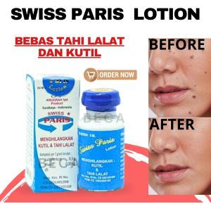 Penghilang Tahi Lalat Dan Kutil Swiss Paris Lotion Menghilangkan Tahi Lalat Dan Kutil