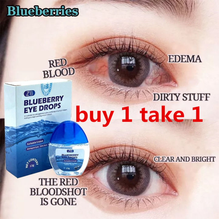 Blueberry Eye Drops Itchy Eyes Eye Drops Dry Eyes Eye Drops