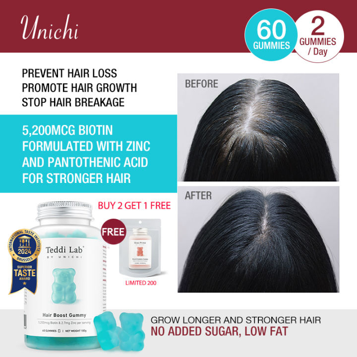 【Unichi】 Biotin Gummies for Hair, Skinand Nails -Vegan Vitamins for Men ...