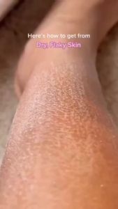Rose Body Oil Moisturizer Lotion 260ml Nourishing Body Anti Aging Smoothing Skin Spa Aromatpy