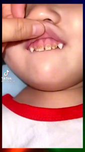 Sikat Gigi anak bentuk U Bahan silikon 2-6 Tahun