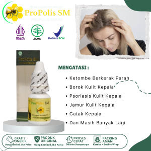 Obat Ketombe Berkerak Parah Borok Kulit Kepala Gatal Kulit Kepala Psoriasis Kulit Kepala Ketombe Menahun Jamur Kulit Kepala - 6 Ml