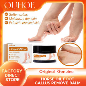 Ouhoe Horse Oil Foot Callus Remove Balm Heel Anti Crack Repair Smooth Removal Dead Skin Callus Anti-Drying Soften Callus Deep Moisturize Nourish Dry Skin Exfoliate Cracked Skin Foot Care 30g
