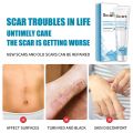 Scar gel remover scar remover cream scar remover for old scar on leg peklat remover cream for old peklat (softens scar tissue and promotes natural skin healing and renewal) ccgray cream. 