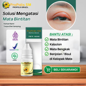 Obat Mata Bintitan Benjolan Di Kelopak Mata Mata Kalazion Mata Timbil Mata Bengkak Bisul Kelopak Mata Propolis SM Herbal Original