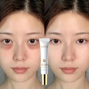 Snails Eye Cream for Dark Circle and Eyebag Eye Cream Serum /  Collagen Anti Wrinkle and Aging Dark Circle Remover Herbal Essence Eye Bag Removal Cream /Cream Untuk Mengatasi Keriput Di Kelopak Mata / Penghilang Kantung Mata Paling Ampuh 20g