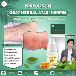 Propolis SM Brazilian Asli 100% Original Untuk Gatal-gatal dan Gatal Berair Menyebar BPOM dan Halal MUI