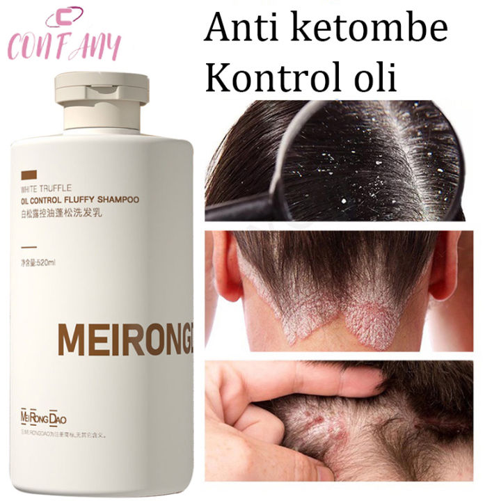 Anti Dandruff Shampoo 520ml Oil Control fluffy hair Antiitch remove