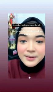 LIP GLOW SR12 PALING LARIS AMPUH MEMBUAT BIBIR PINK MERONA/LIP SERUM LIP TINT LIP BALM AMPUH MENUTRISI BIBIR YANG RUSAK