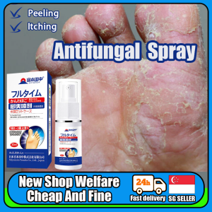 【SG Stock】Anti Fungal Spray/ Foot Deodorant Spray 30ml/ Athlete Foot Treatment/ Peeling Antiperspirant Relief/ Itchy Fungal Infection Herbal Formula/ Safe And Non-irritating