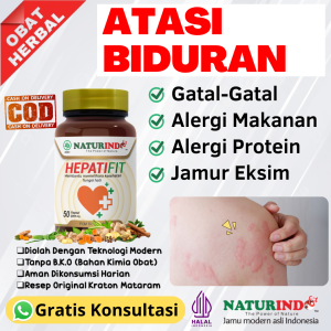 Obat Biduran Paling Ampuh Obat Gatal Alergi Dingin Obat Biduran Dewasa Obat Biduran Untuk Anak Obat Biduran Menahun Ampuh Obat Gatal Gatal Obat Alergi Gatal Kulit Paling Ampuh Obat Alergi Dingin Kulit Gatal Bentol COD