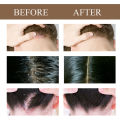 Sampo anti ketombe Mencegah rambut rontok Mencegah ketombe Sampo garam laut Shampo anti tungau Shampo Aroma 300ml Mencegah rambut berminyak Antiketombe antipruritic oil control asam amino panjang. 