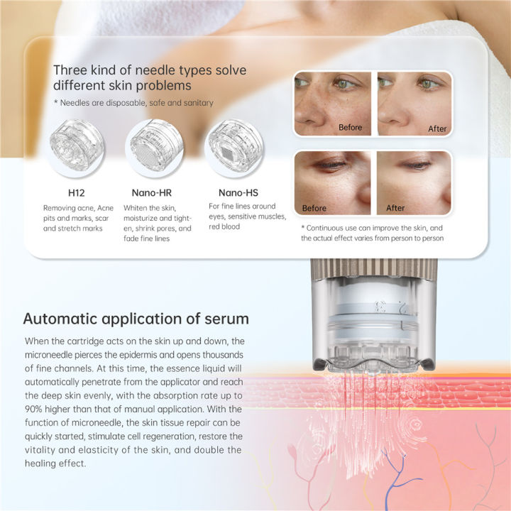 Hydra.Pen%20H3%20kh%C3%B4ng%20d%C3%A2y%20Chuy%C3%AAn%20nghi%E1%BB%87p%20microneedling%20v%E1%BB%9Bi%2012%20c%C3%A1i%20h%E1%BB%99p%20m%E1%BB%B1c%20microneed-le%20Derma%20c%C3%A1n%20l%C3%A0m%20%C4%91%E1%BA%B9p%20ch%C4%83m%20s%C3%B3c%20da%20c%C3%B4ng%20c%E1%BB%A5%20-%20Image%204