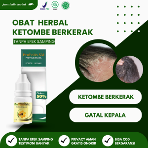 Obat Ketombe Parah - Obat Ketombe Berkerak - Obat Ketombe Membandel Menahun - Propolis SM Brazil