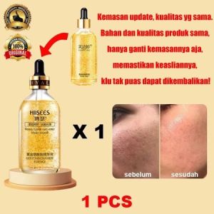 VON Obat Jerawat Paling Ampuh Salep Jerawat dan Bekas Jerawat Serum Penghilang Bekas Jerawat 25g Penghilang Lubang Jerawat Serum / Penghilang Bopeng Bekas Jerawat