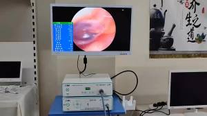 Visual Ear Cleaning Instrument Equipment Visual Otoscope HD Endoscope Professional Visual Ear Cleaning Machine Professional Ear Cleaning Device