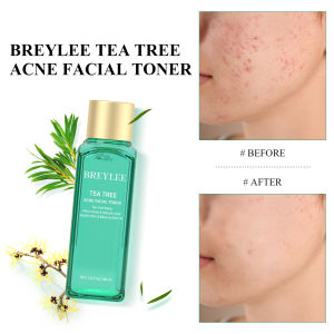BREYLEE Acne Treatment Toner Moisturizer Skincare Face Serum Pimple Remover Soothing Oil Control Essence 100ml