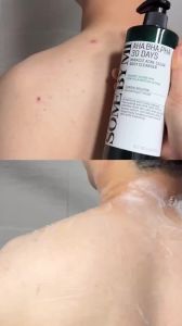 [Acne Care] SOME BY MI AHA BHA PHA 30 Days Miracle Acne Clear Body Cleanser 400g