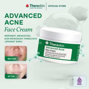 Theraskin BPOM Advanced Acne Face Cream - Krim anti-acne untuk Kulit Berjerawat dan Bruntusan dengan Salicylic Acid Tea Tree Oil dan Sulfur