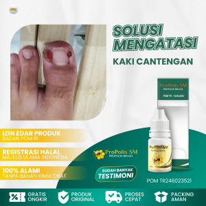 Obat Jempol Kaki Cantengan Obat Cantengan ParahObat Jempol Kaki Bengkak Kuku Jempol Cantengen Cantengan Kuku Kaki & Tangan Cantengan Bau dan Bernanah Obat Sakit Jempol Kaki Obat Cantengan Kuku Kaki - Propolis SM Asli 100% Original