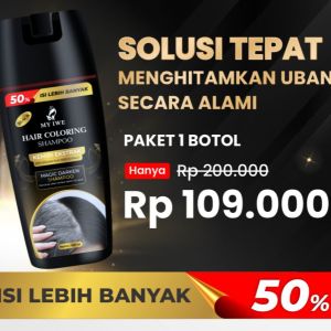 Myiwe Hair Growth Serum 50 ml Penumbuh Rambut Botak dan Cegah Rontok BPOM / Serum rambut rontok rusak Serum rambut smoothing Serum rambut penumbuh rambut Serum rambut rusak dan kering Serum rambut pelurus dan lembut