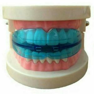 Perapi Gigi Tanpa Behel Teeth Trainer PREMIUM Original