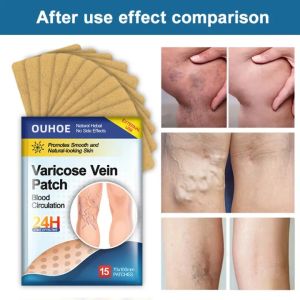 Miếng dán Thảo Dược Hỗ Trợ Giảm Giãn Tĩnh Mạch Chống Giãn Tĩnh Mạch Làm Dịu Chân