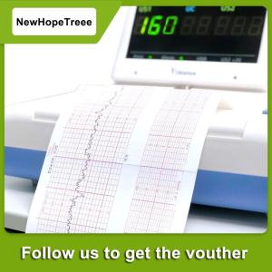 NewHopeTreee ECG เครื่อง EKG 50มม. x 20ม. 80มม. x 20 110มม. x 20ม. 210มม. x 20ม.