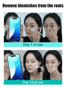 Gentle Tear Mask Skin Care Nourishing Hydrating Rejuvenating Cleansing Keratin Collagen Mask