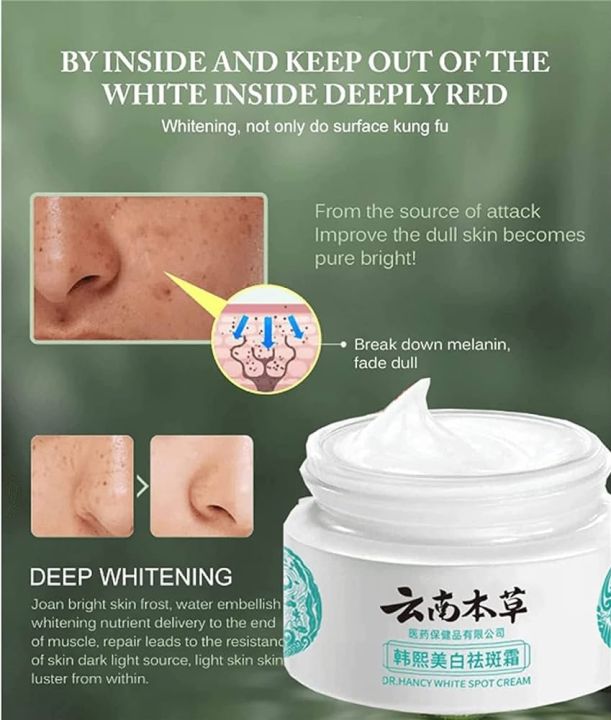OSTRI Japanische Melasma-Creme – Dr. Hancy Weiße Flecken Creme Gegen Pigmentflecken