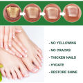 EELHOE Nail Fungus Repair Liquid Remove Onychomycosis Treatment Essence Serum Anti-infective Nourishing Brighten Foot Nail Oil Anti-Fungus Onychomycosis-Removal Liquid Ginger Foot Antifungal Nail Essence. 