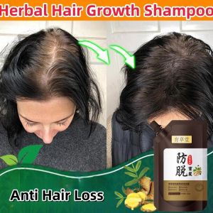 Yucaotang Herbal Shampoo: A Natural Solution for Hair Growth & Anti-Hair Loss