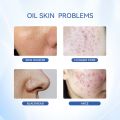 Dr.Leo Perawatan Jerawat 2PCS Kit - Salicylic Acid Acne Treatment Drying Lotion 10mlDr.Leo Salicylic Acid Acne Treatment Drying Lotion 10ml + Amazon White Deep Pores Cleansing & Purifying Clay Mask. 