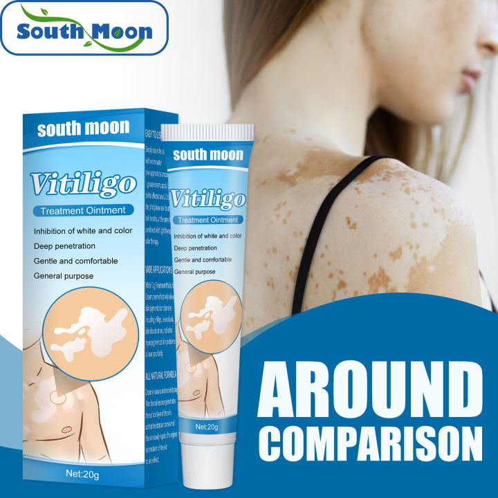 South Moon White Spot Psoriasis Cream Vitiligo Treatment Ointment South Moon White Spot Psoriasis Cream Vitiligo Treatment Ointment