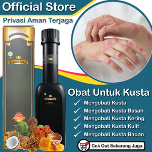 Obat Kusta Paling Ampuh - Kusta Kering - Kusta Basah - Kusta Kulit - Kusta Badan - Lepra - Herbal Penghilang Kusta - Mbiopro Herbal Alami