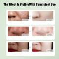 Hot deals Salicylic Acid Daily Gentle Facial Cleanser Removes Acne Whitens and Removes Blackheads By Exfoliating and Keeping Pores Clean to Restore Asid Salicylic Pembersih Muka Lembut Harian  水杨酸每日温和洁面乳通过去角质和保持毛孔清洁来去除痤疮美白和黑头. 
