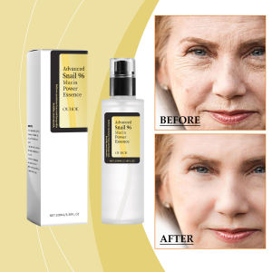 Snail Hydrating Essence Deep Moisture + Glow For Dry/Sensitive Skin Fast Absorbing Radiant Complexion Serum