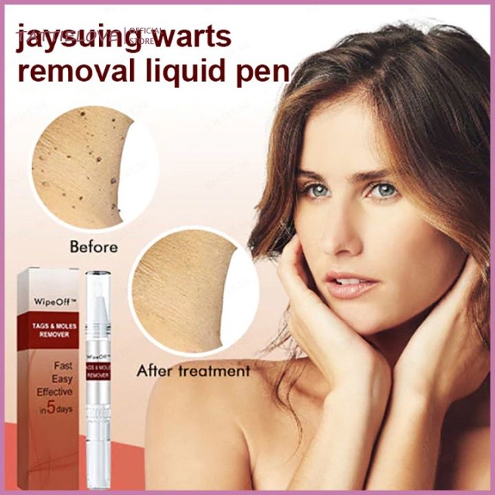 Tattielove Jaysuing Liquid Warts Flat Eliminate Wart Pen Liquid Hand ...