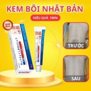 Kem Bôi Ngứa Đa Vùng Nhật Bản 15g – Giảm Ngứa Khô Da Nứt Nẻ Không Bết Dính