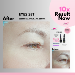 Eye Set - Dark Eye Circle/ Wrinkle / Eye Bags