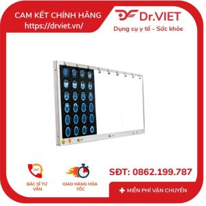 ĐÈN ĐỌC FLIM Y KHOA