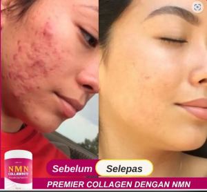 NMN CollaWhite 10x ganda serapan kolagen gabungan Hydrolyzed Collagen Tripeptide