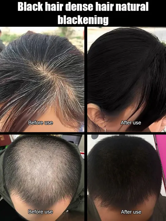 %E3%80%90Darker%20Hair%20With%20Every%20Wash%E3%80%91Cordyceps%20Oil-Control%20Shampoo%20Cordyceps%20Repairing%20Nourishing%20Shampoo%20Conditioning%20Shampoo%20-%20Image%208